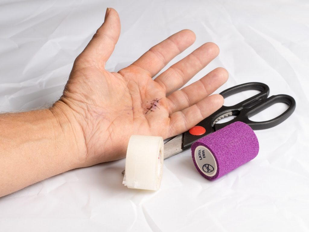 Do I Need Stitches 9 Obvious Signs You Should Not Ignore State 